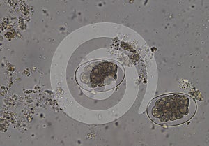 Hook worm eggs of pasasite
