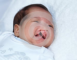 Hoping her cries dont go unheard. Closeup shot of a baby girl with a cleft palate.