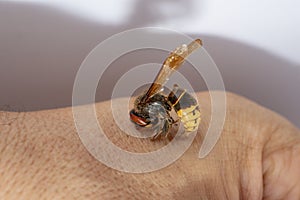 Hornet bites a manÃ¢â¬â¢s hand on a white background