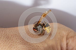 Hornet bites a manâ€™s hand on a white background