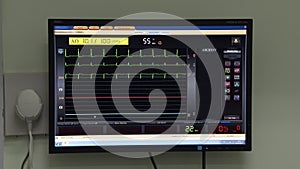 Hospital heart rate monitor with diagram