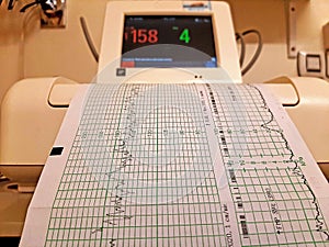 Hospital machine printing patient vital signs