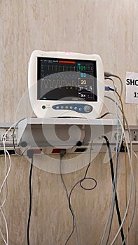 Hospital monitor, shows the vital signs of a person, the cables that connect to the person can be seen