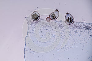 Host cells with spores mold are inside wood under the microscope .