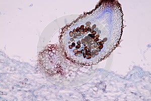 Host cells with spores mold are inside wood under the microscope .