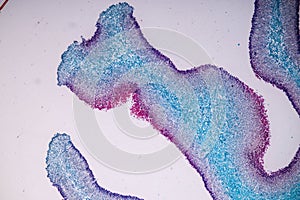 Host cells with spores mold are inside wood under the microscope .