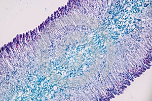 Host cells with spores mold are inside wood under the microscope .