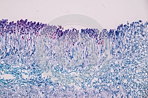 Host cells with spores mold are inside wood under the microscope .