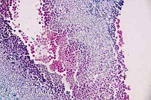 Host cells with spores mold are inside wood under the microscope .