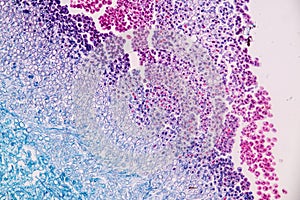 Host cells with spores mold are inside wood under the microscope .