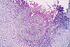 Host cells with spores mold are inside wood under the microscope .