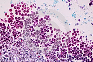 Host cells with spores mold are inside wood under the microscope .