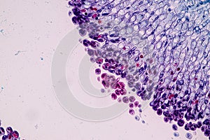 Host cells with spores mold are inside wood under the microscope .