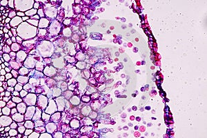 Host cells with spores mold are inside wood under the microscope