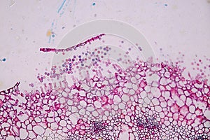 Host cells with spores mold are inside wood under the microscope