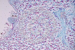 Host cells with spores mold are inside wood under the microscope.