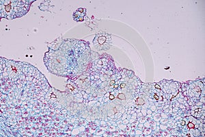 Host cells with spores mold are inside wood under the microscope.