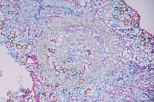 Host cells with spores mold are inside wood under the microscope.