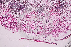 Host cells with spores mold are inside wood under the microscope.