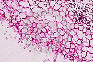 Host cells with spores mold are inside wood under the microscope.