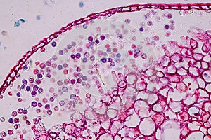 Host cells with spores mold are inside wood under the microscope.