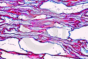 Host cells with spores mold are inside wood under the microscope.