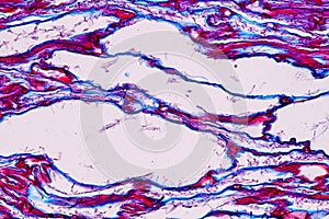 Host cells with spores mold are inside wood under the microscope.