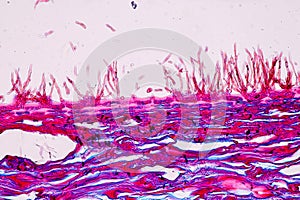 Host cells with spores mold are inside wood under the microscope.