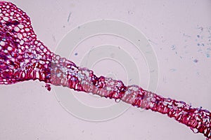 Host cells with spores mold are inside wood under the microscope.