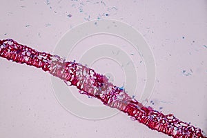 Host cells with spores mold are inside wood under the microscope.