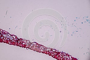 Host cells with spores mold are inside wood under the microscope.