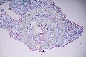 Host cells with spores mold are inside wood under the microscope.