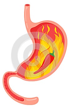 Hot food stomach problem. Gastric pain icon