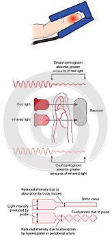 How a pulse oximeter works