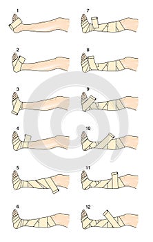 How to apply a Putter leg bandage photo