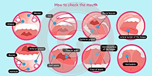How to check the mouth