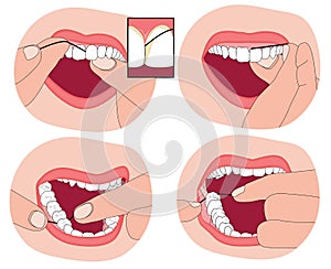 How to floss your teeth