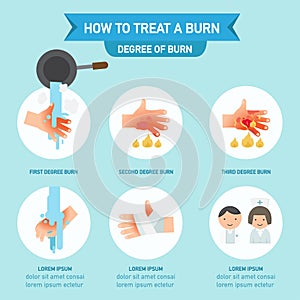 How to treat a burn infographic,vector illustration photo