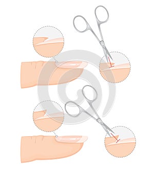 How to Trim Cuticles Professionally with Scissors. Professional Manicure Guide. Vector