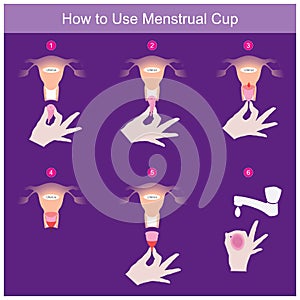 How to Use Menstrual Cup. Illustration explain in use Menstruation Cup for women