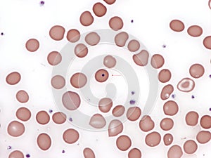Howell-Jolly body in a peripheral blood erythrocyte.