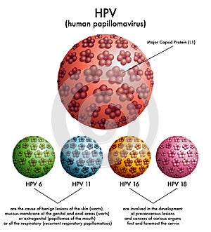 HPV (human papillomavirus)