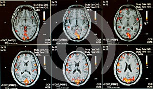 Hombre activo cerebro 