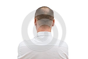 Human alopecia or hair loss - adult men bald head. back of balding man from shoulders isolated on white background