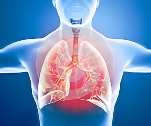 Human anatomy, problems with the respiratory system, severely damaged lungs. Bilateral pneumonia