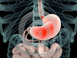 Human anatomy xray-like view of abdomen and intestines showing acid reflux.