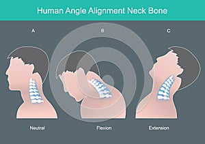 Human angle alignment neck bone.