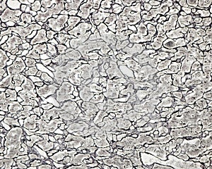 Human anterior pituitary. Reticular fibers. Silver stain
