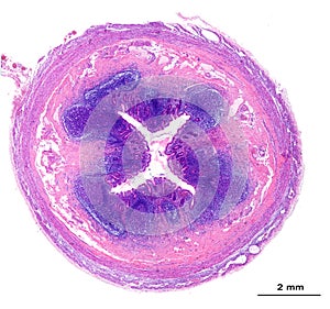 Human appendix