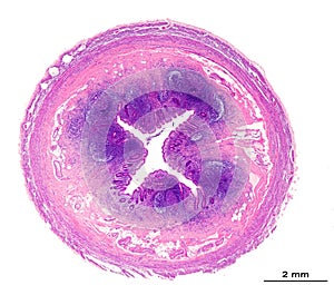 Small intestine. Paneth cells photo